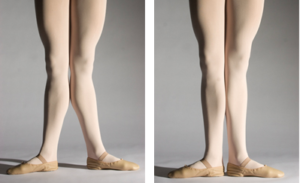hiperextensiones tipos